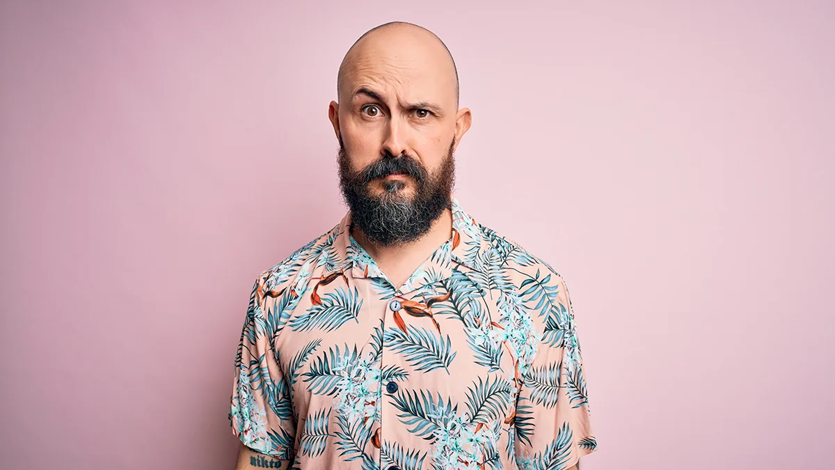 a man in a hawaian shirt with typical male pattern baldness